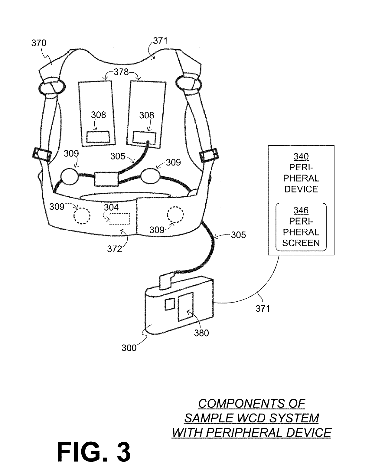 Wearable cardioverter defibrillator (WCD) system having main ui that conveys message and peripheral device that amplifies the message