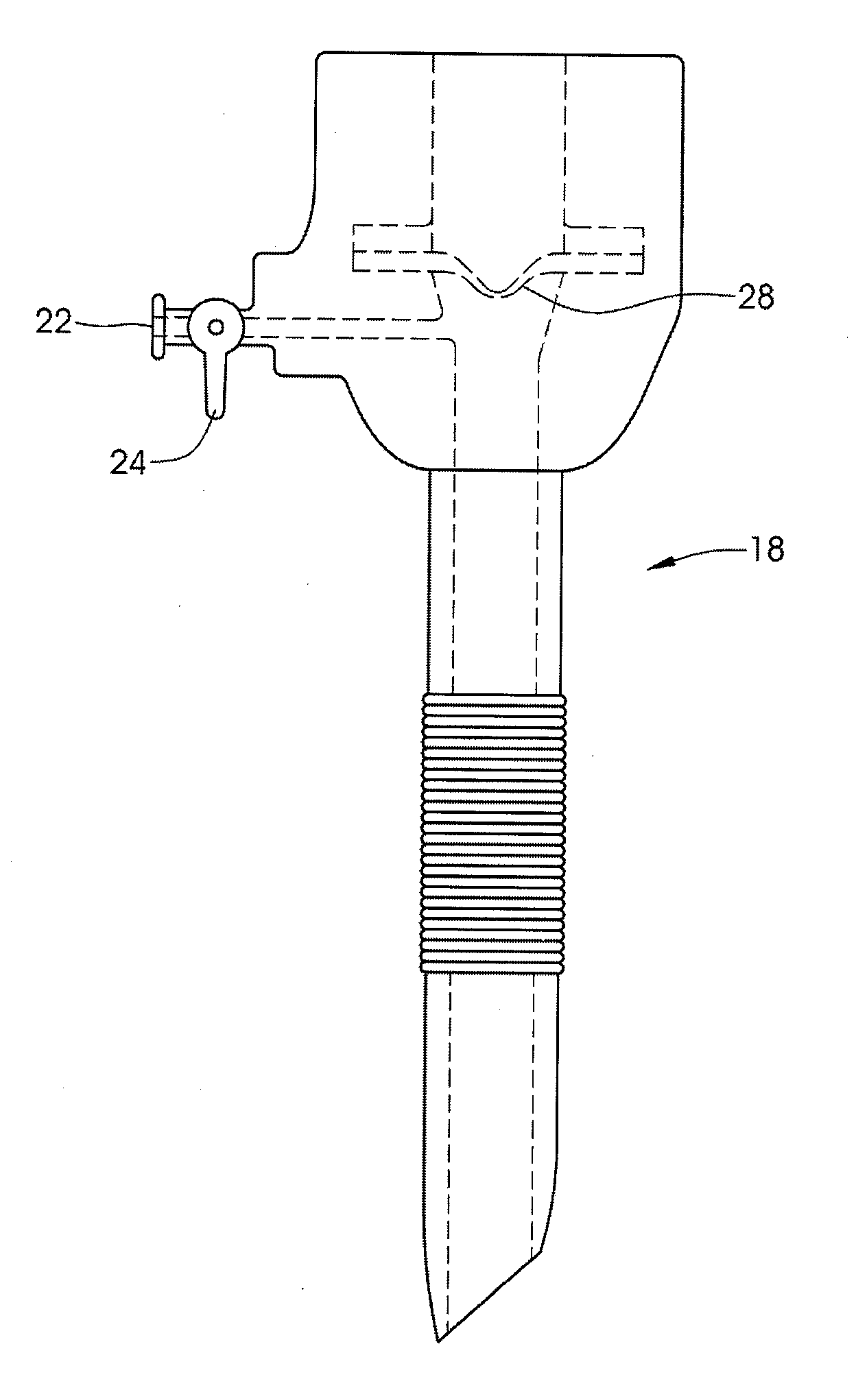 System and method for securing an implantable interface to a mammal