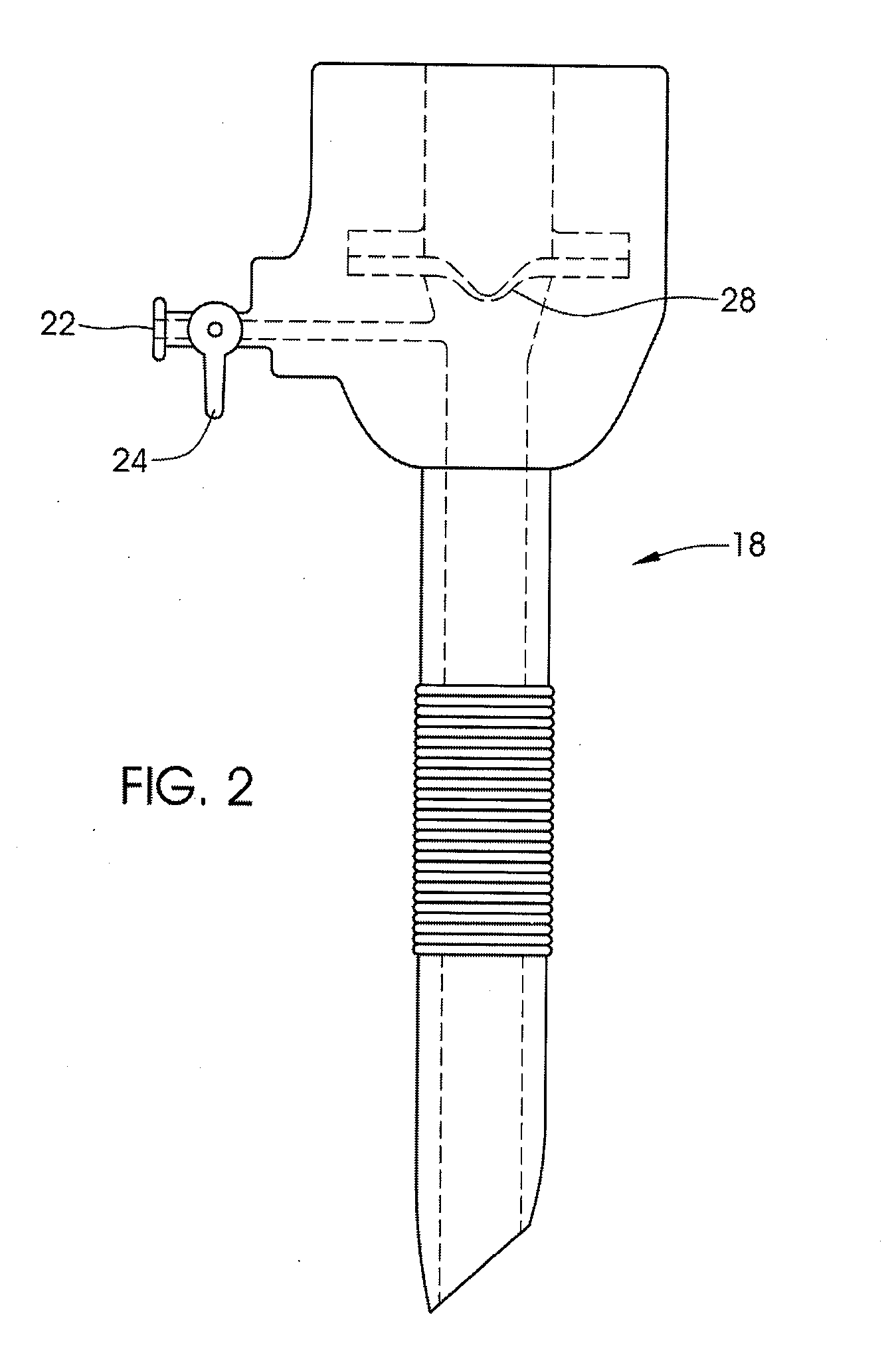 System and method for securing an implantable interface to a mammal