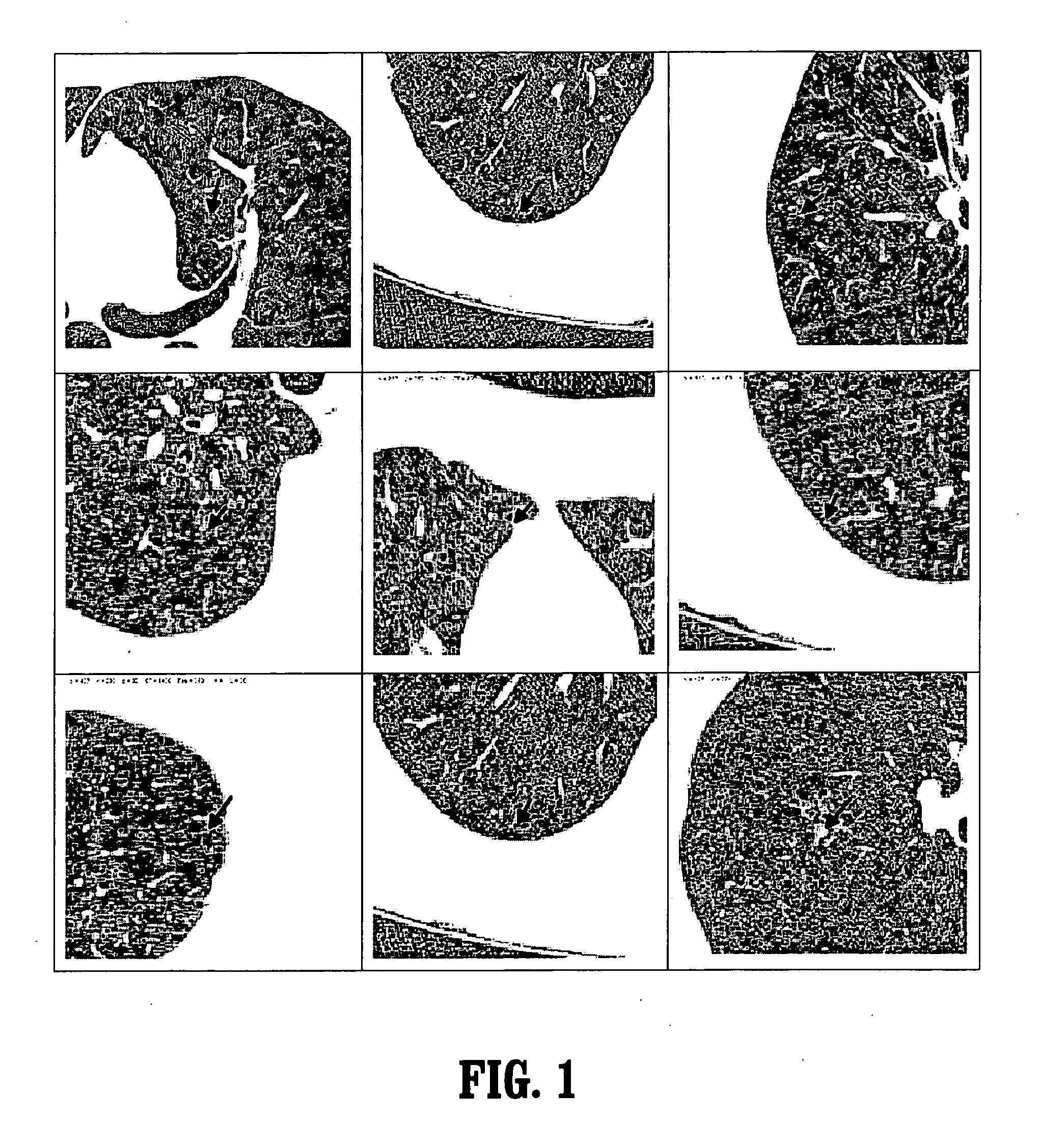System and method for detecting ground glass nodules in medical images