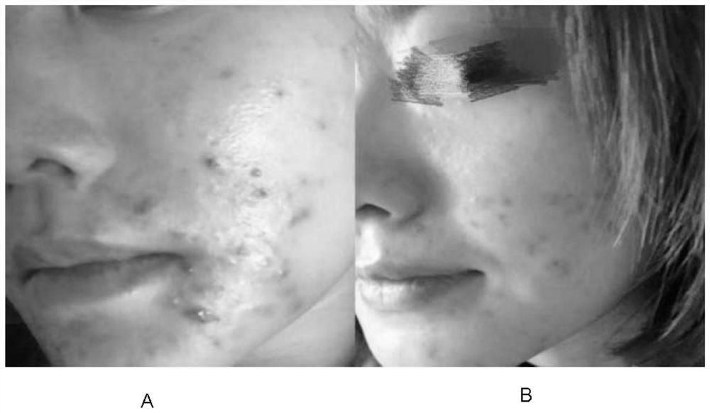 Skin care lotion and preparation method thereof