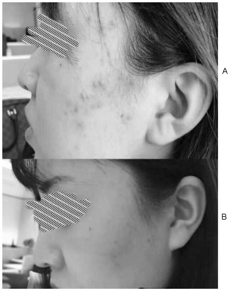 Skin care lotion and preparation method thereof