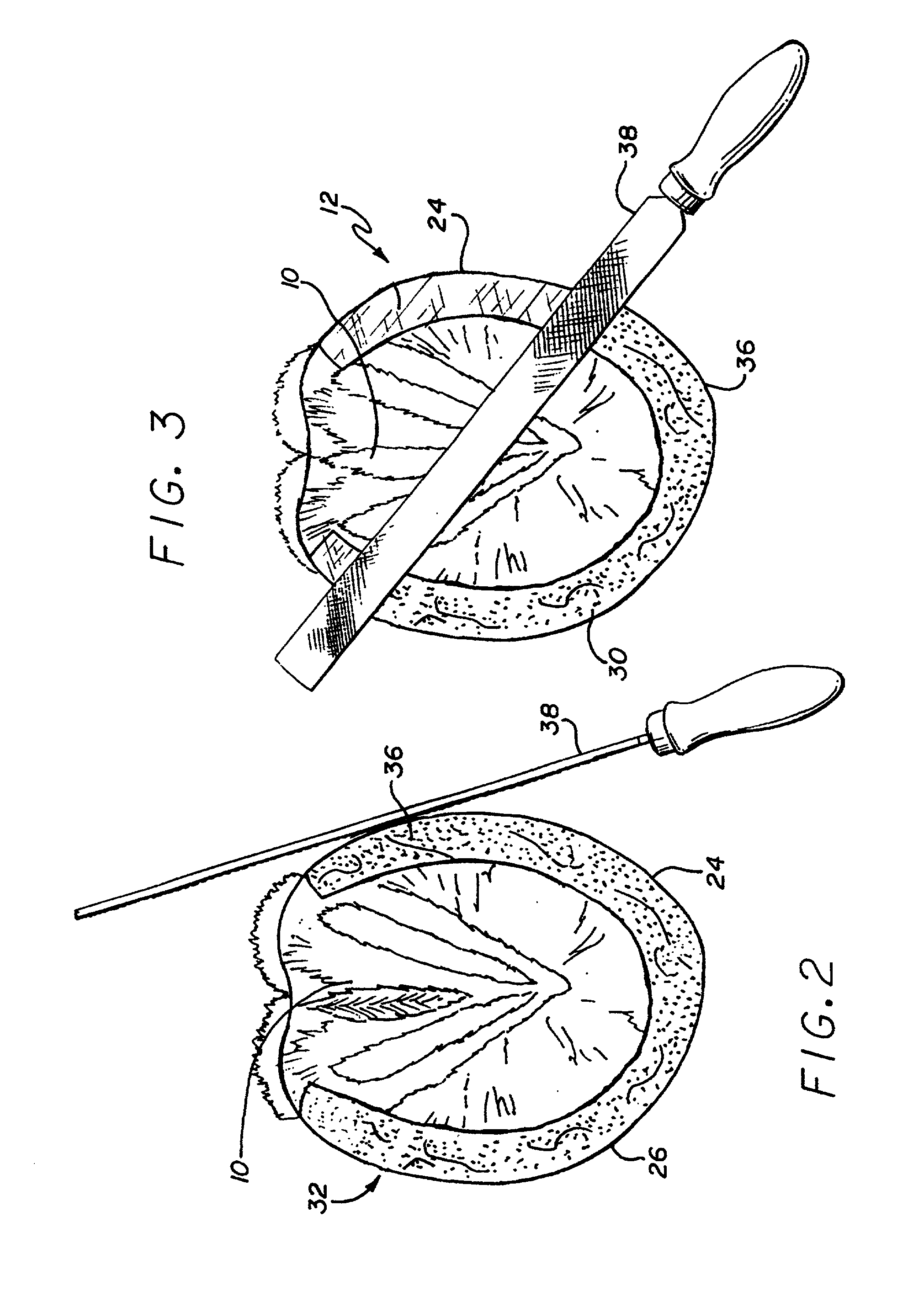 In situ horseshoeing