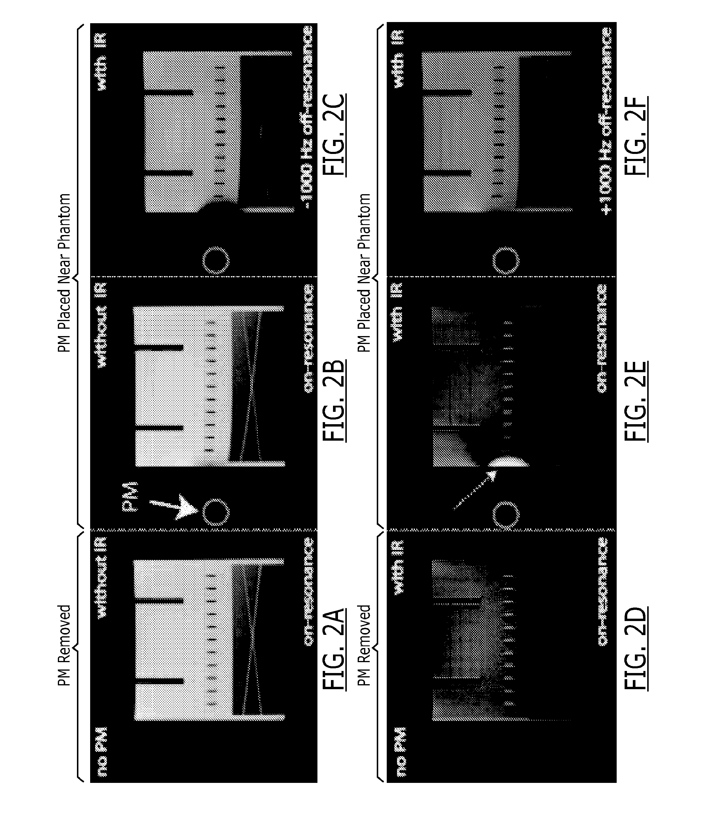 Cardiac late gadolinium enhancement MRI for patients with implanted cardiac devices