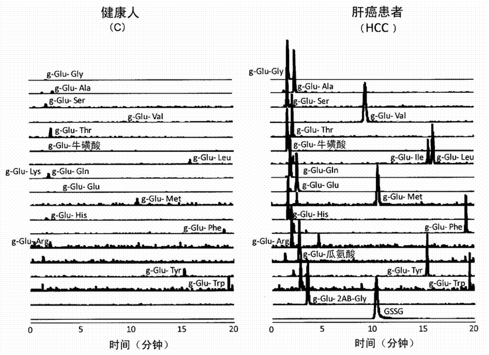 Liver disease marker, method and apparatus for measuring same, and test method for pharmaceutical preparation