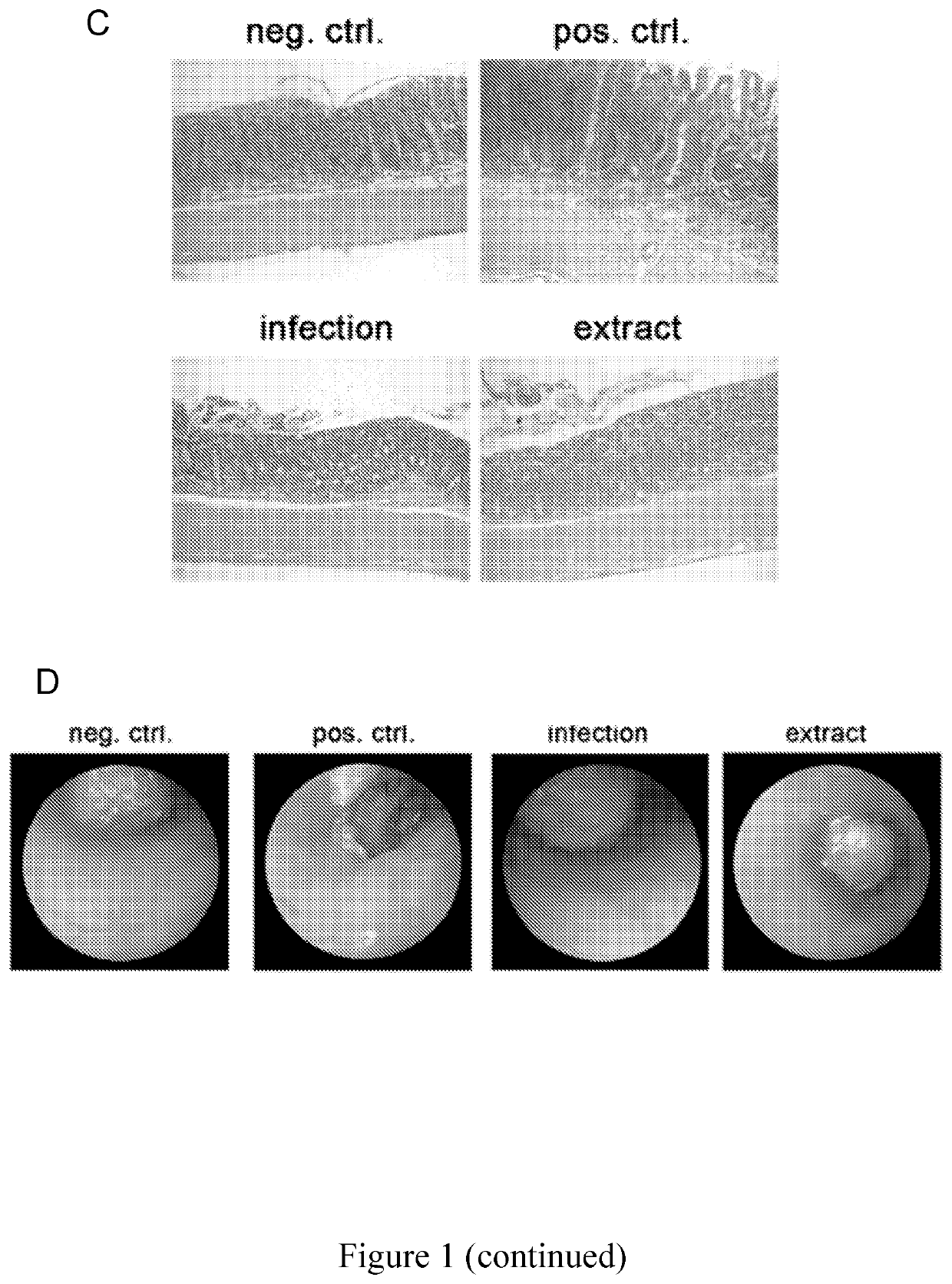 Use of heliocbacter pylori extract for treating or preventing inflammatory bowel diseases and coeliac disease