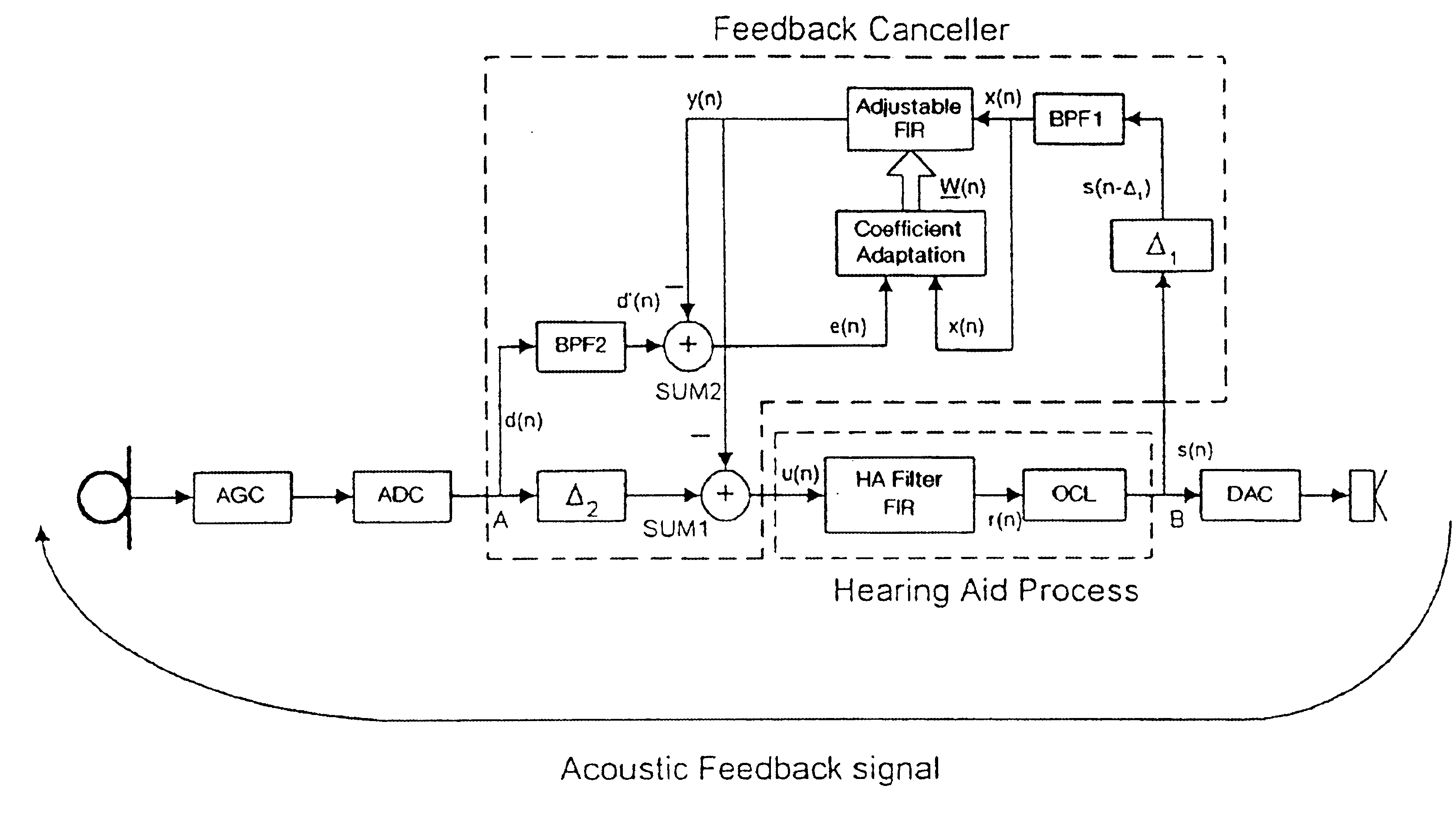 Band-limited adaptive feedback canceller for hearing aids