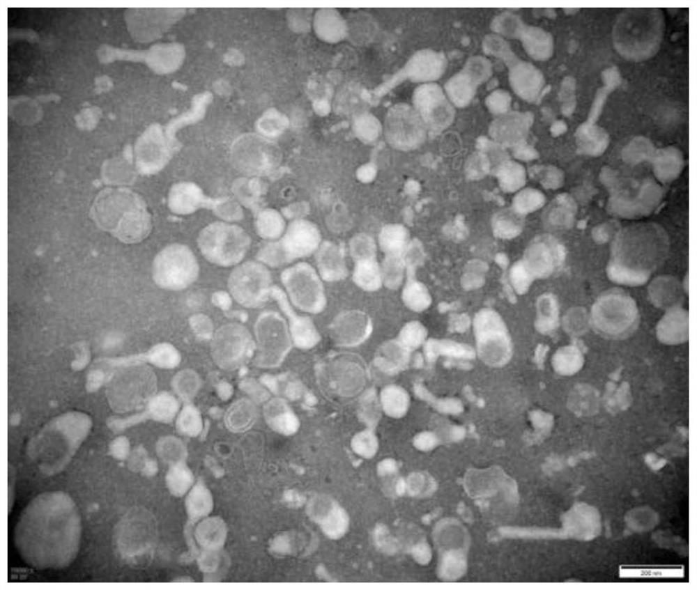 Application of mesenchymal stem cell exosome