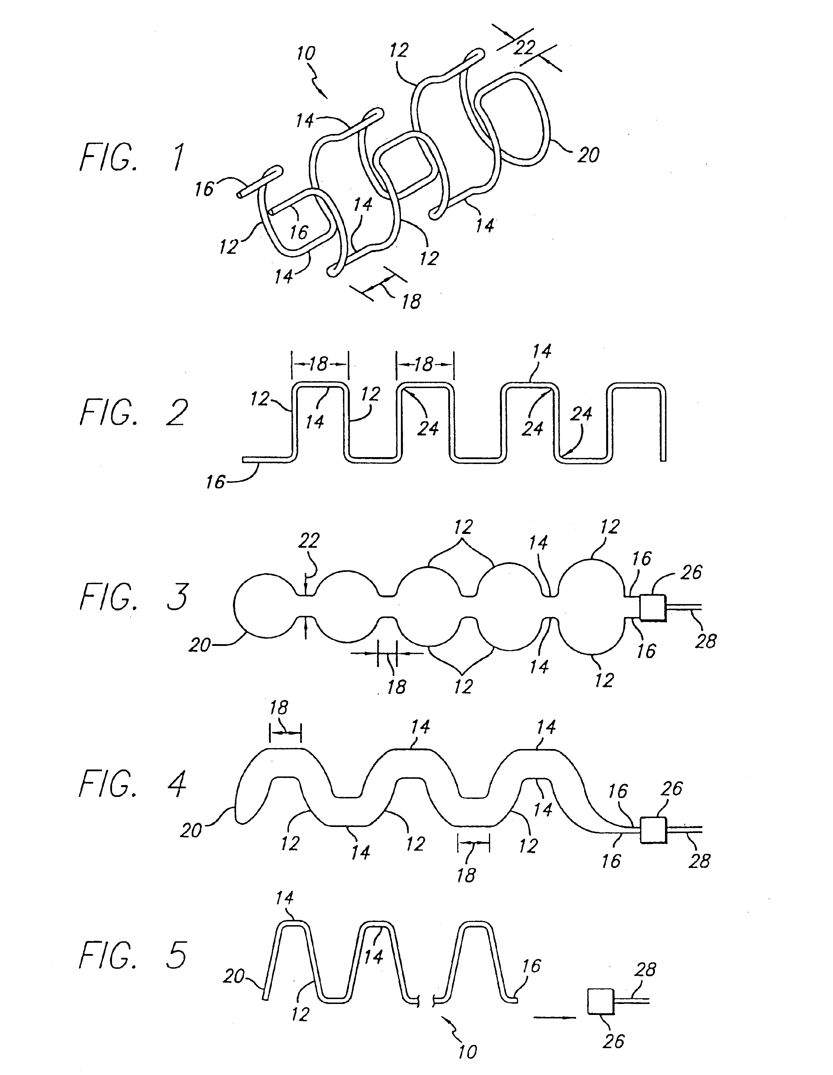 Intravascular flow modifier and reinforcement device