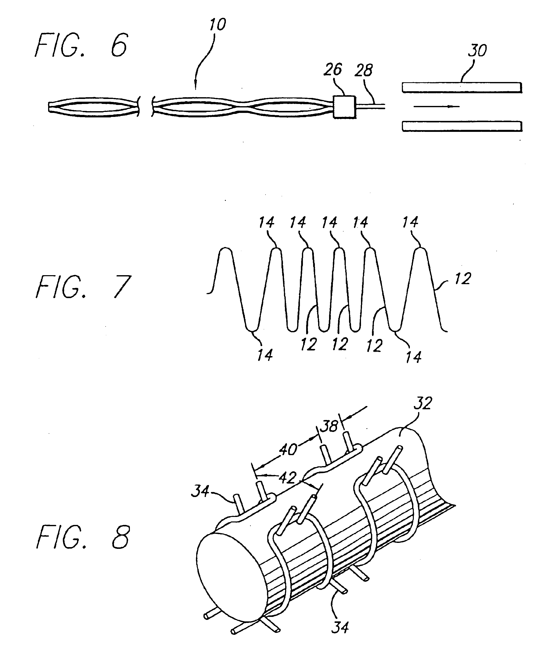Intravascular flow modifier and reinforcement device