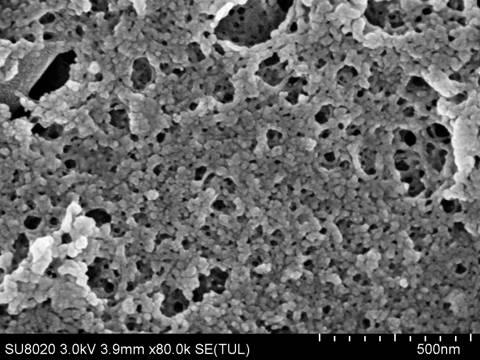 Preparation and application for silver nanometer targeting tumor treatment system