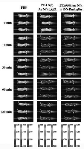 Preparation and application for silver nanometer targeting tumor treatment system