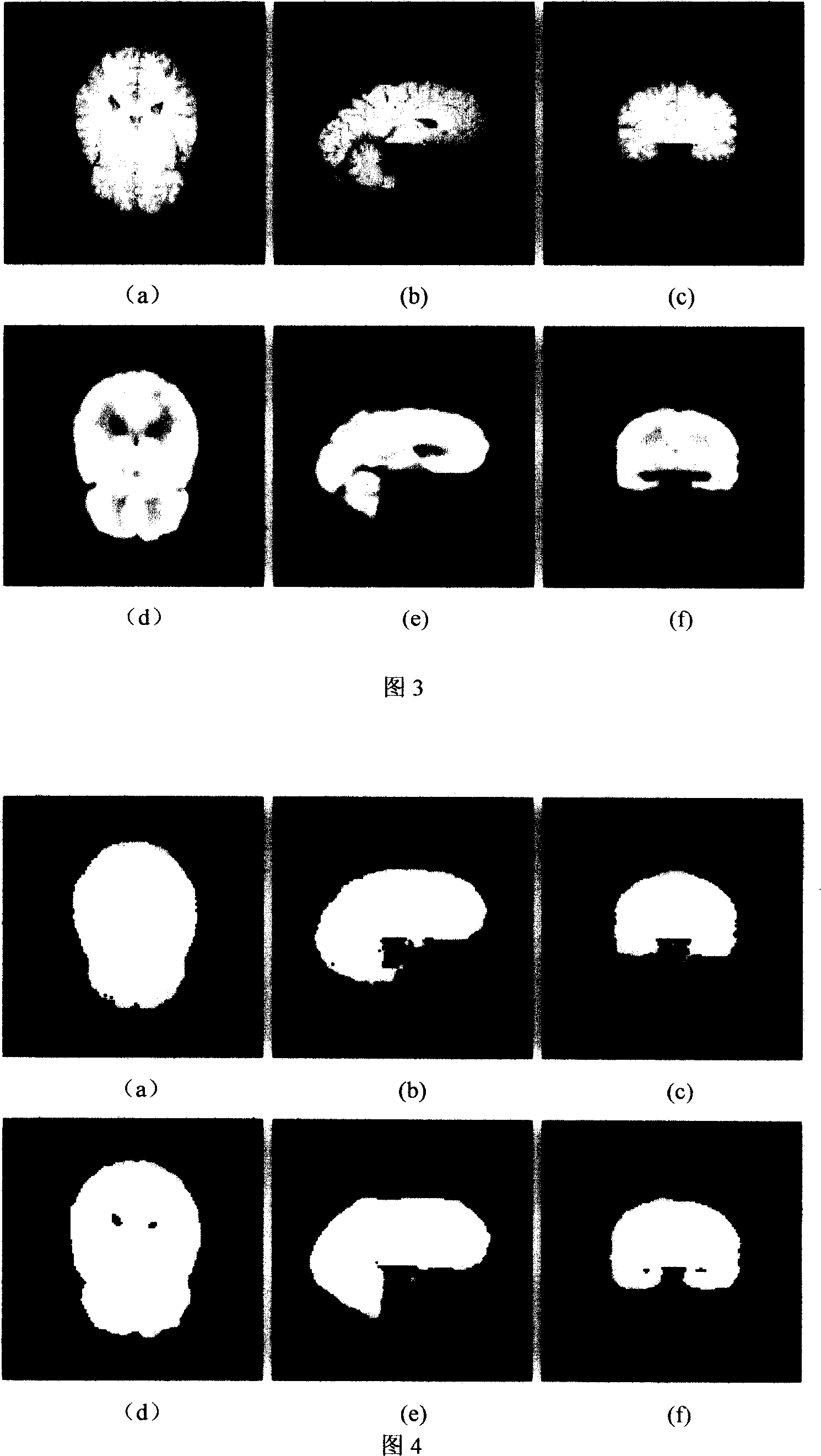 Registration method of three dimension image