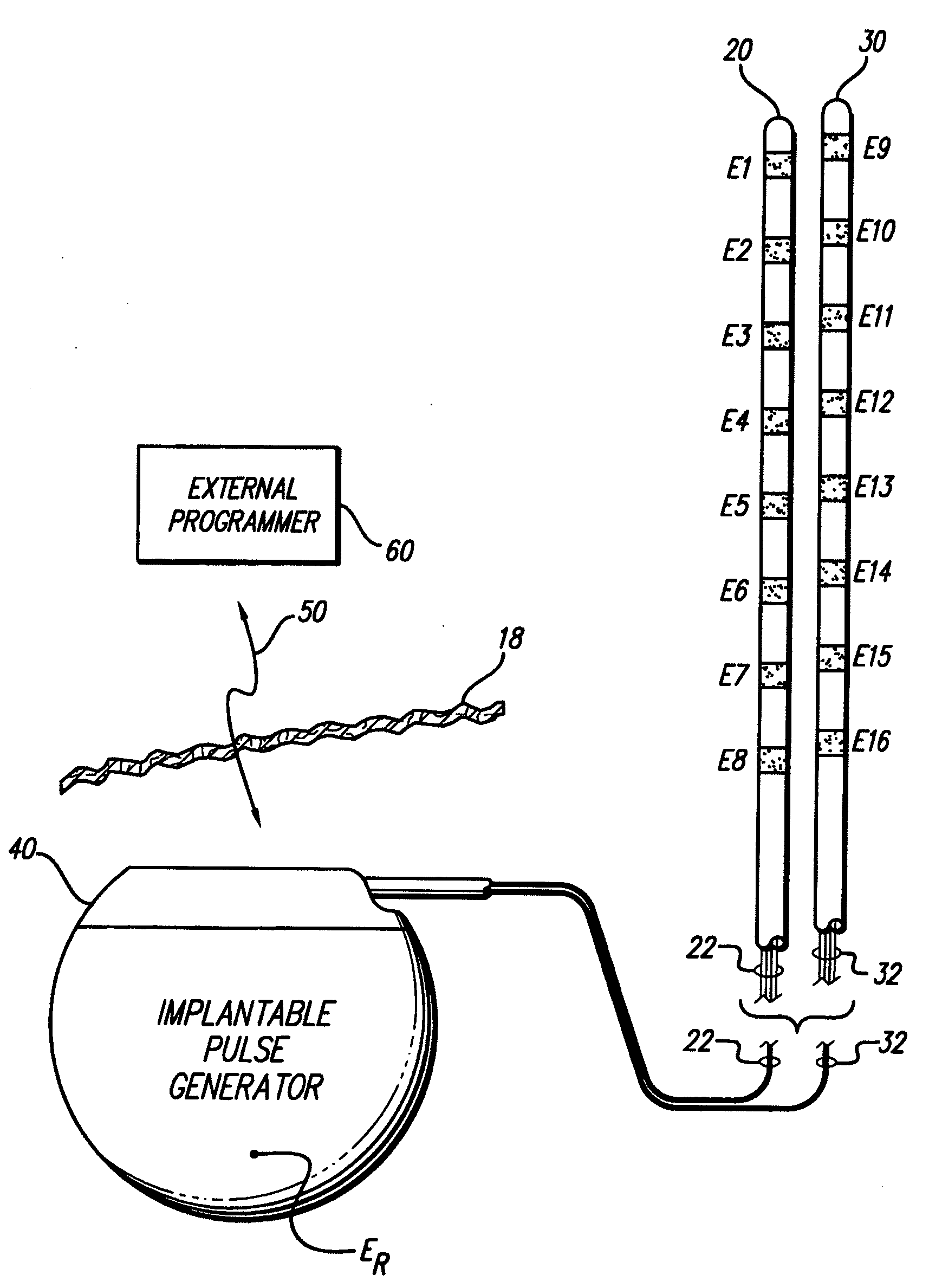 Apparatus and method for determining the relative position and orientation of neurostimulation leads