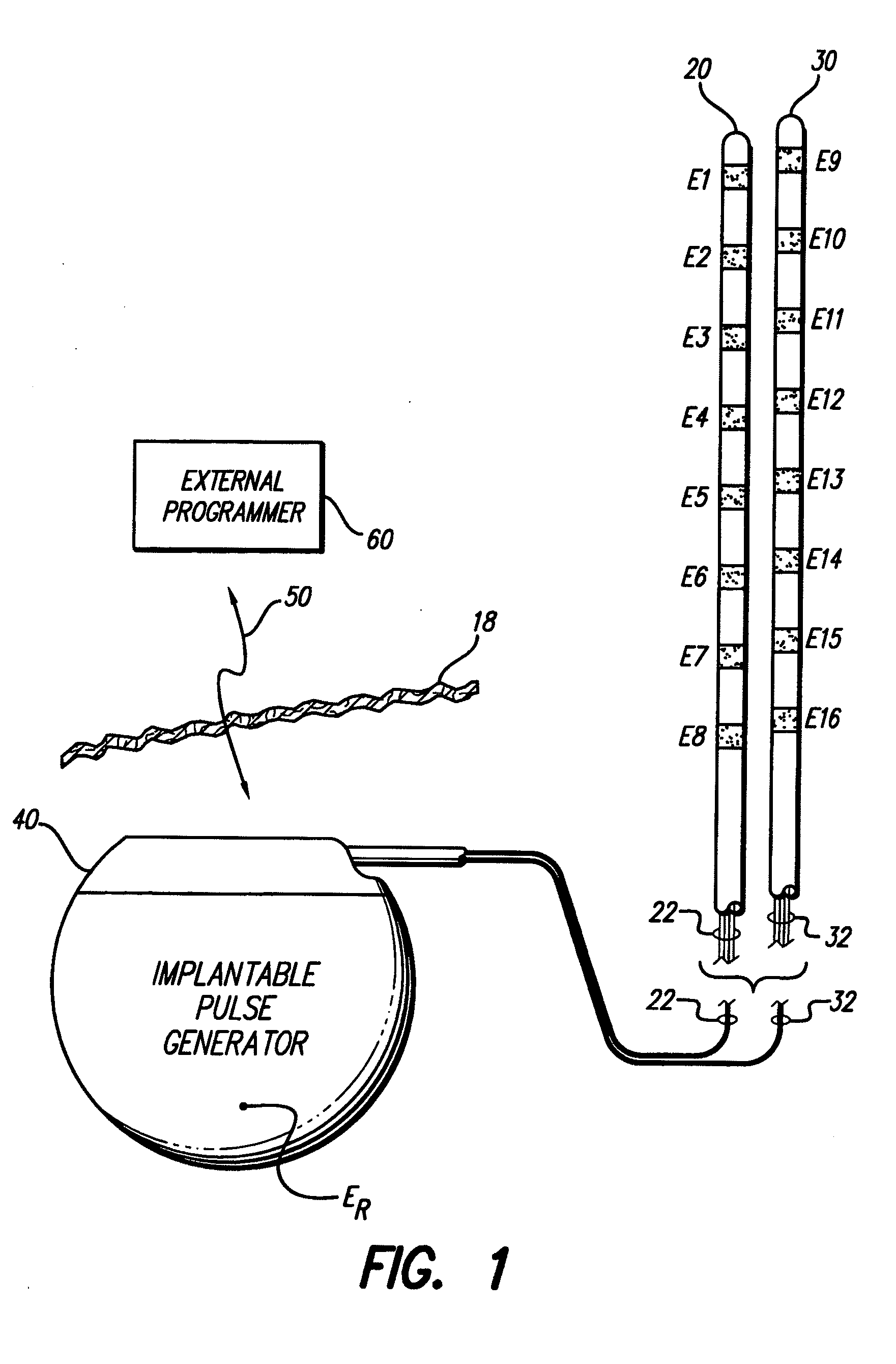 Apparatus and method for determining the relative position and orientation of neurostimulation leads