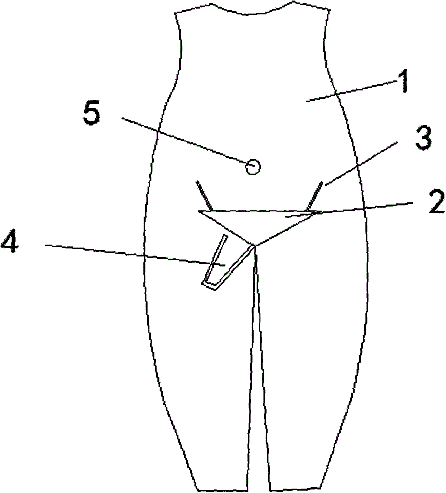 Fabric garment with catheter and umbrella structure