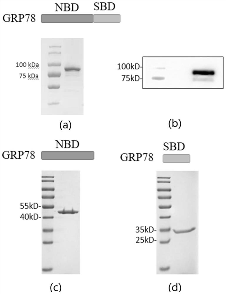 A nanobody targeting glucose regulatory protein 78 and its application