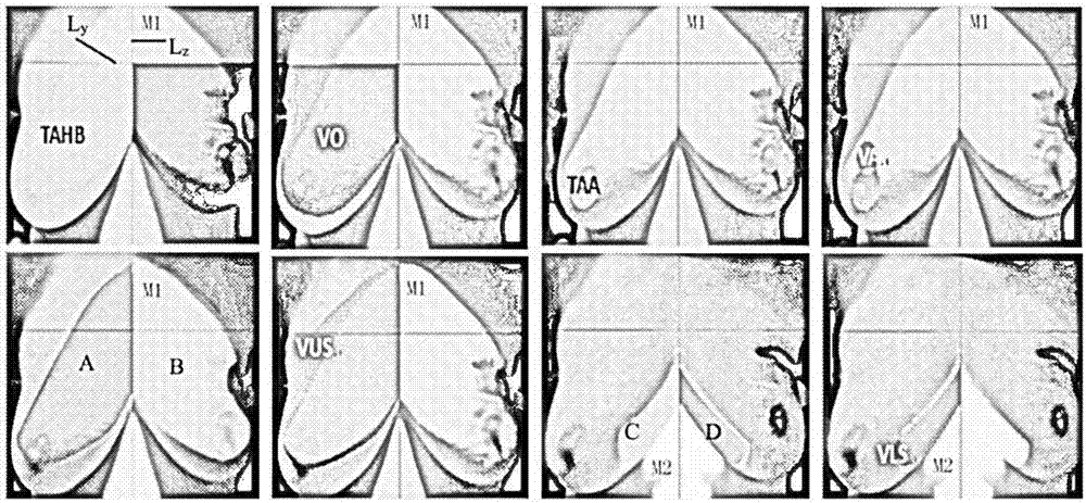 Full-scale breast measurer and breast symmetry assessing method based on same