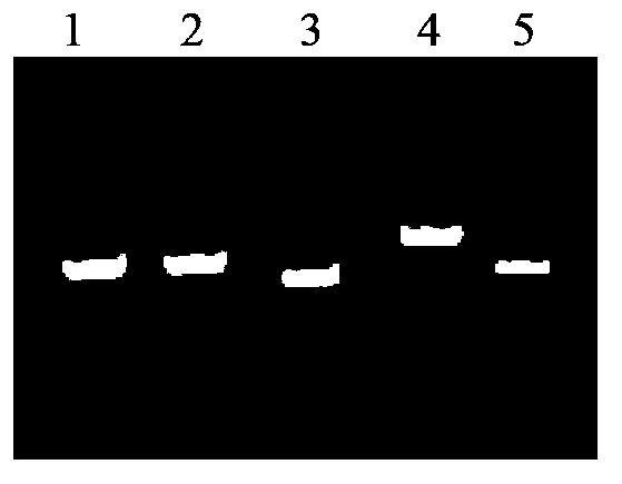 Polymerase chain reaction-sequence based typing (PCR-SBT) method and reagent for human neutrophil alloantigen (HNA) 1-5 system gene typing