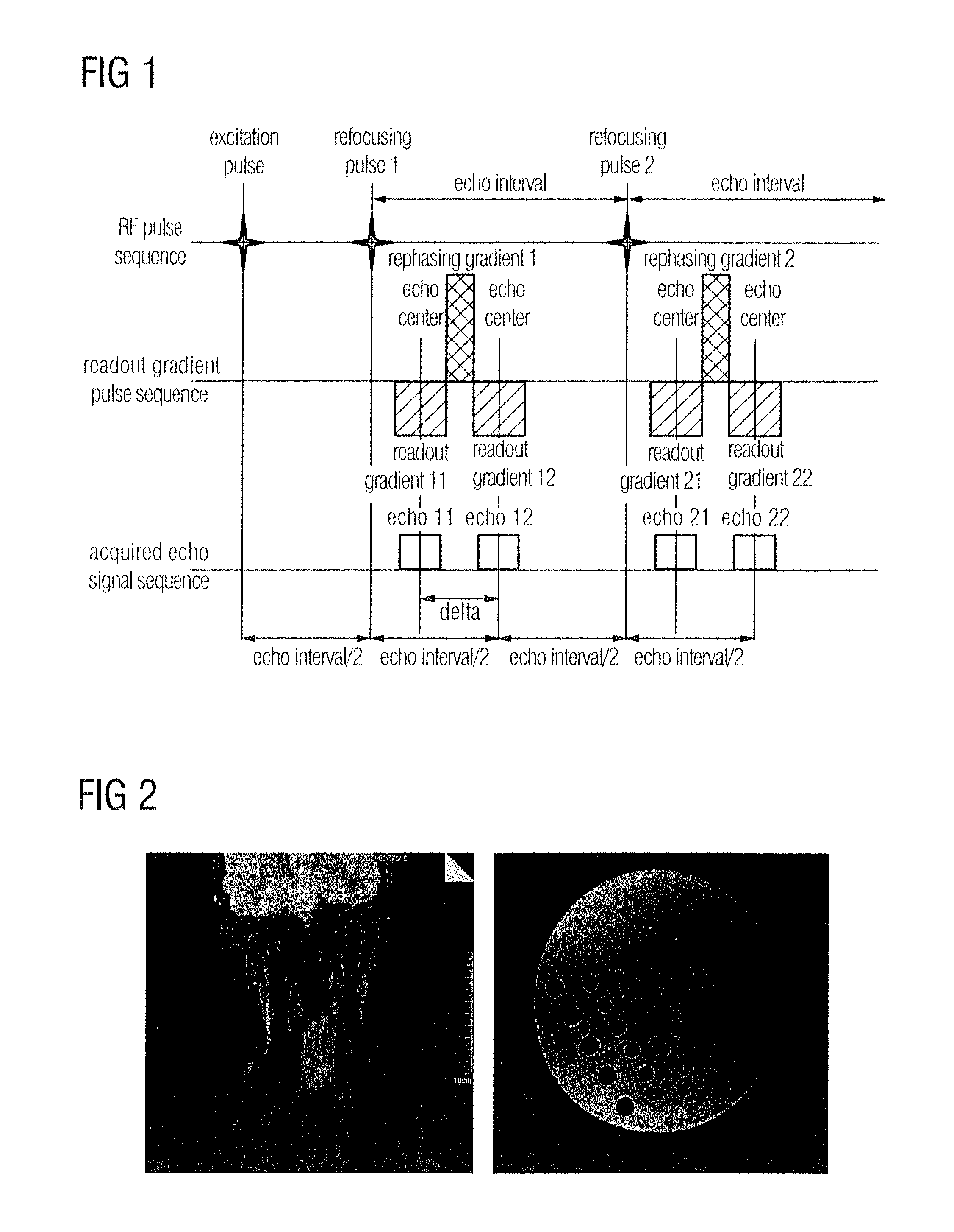 Imaging method and device for water/fat separation in magnetic resonance imaging
