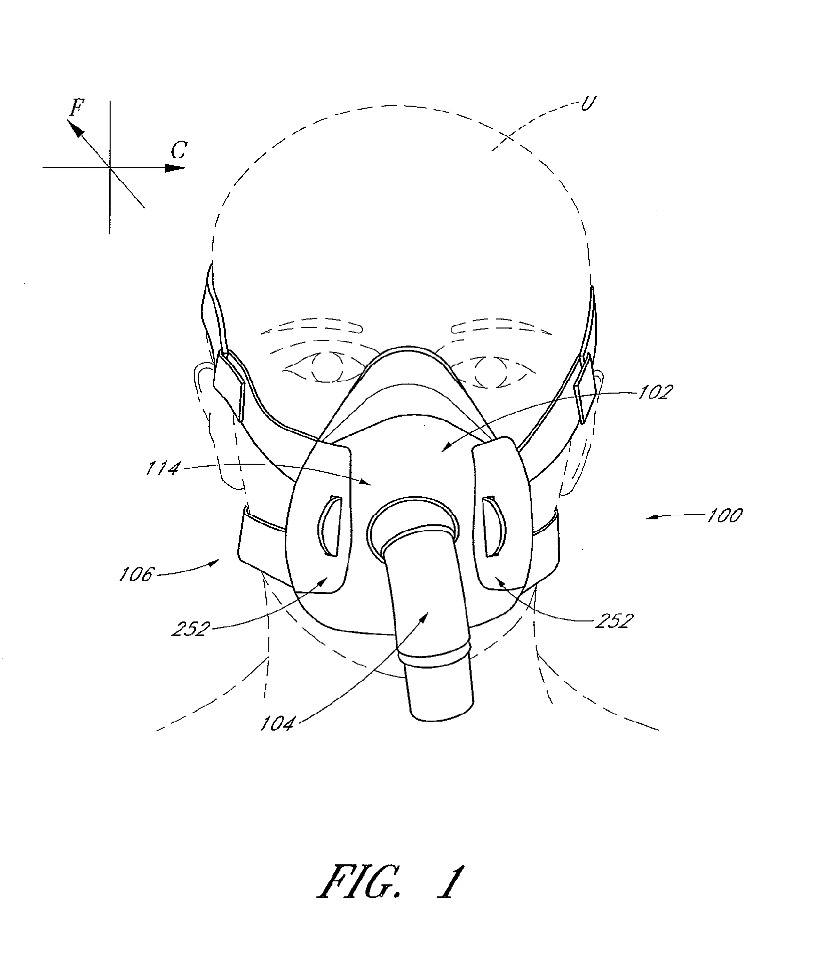 Interface comprising a rolling nasal bridge portion