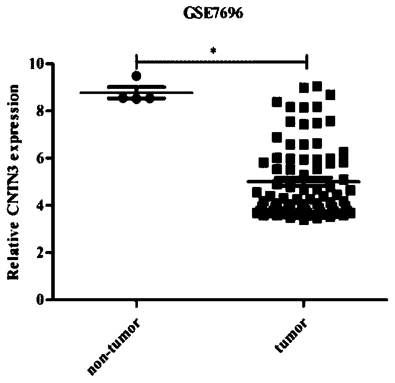 Application of CNTN3 protein in prognosis judgement of neuroglioma