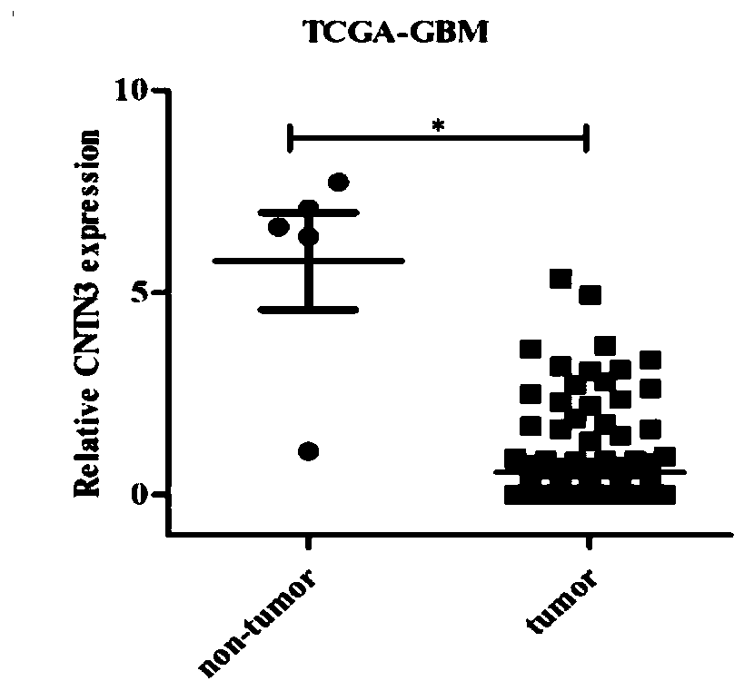 Application of CNTN3 protein in prognosis judgement of neuroglioma