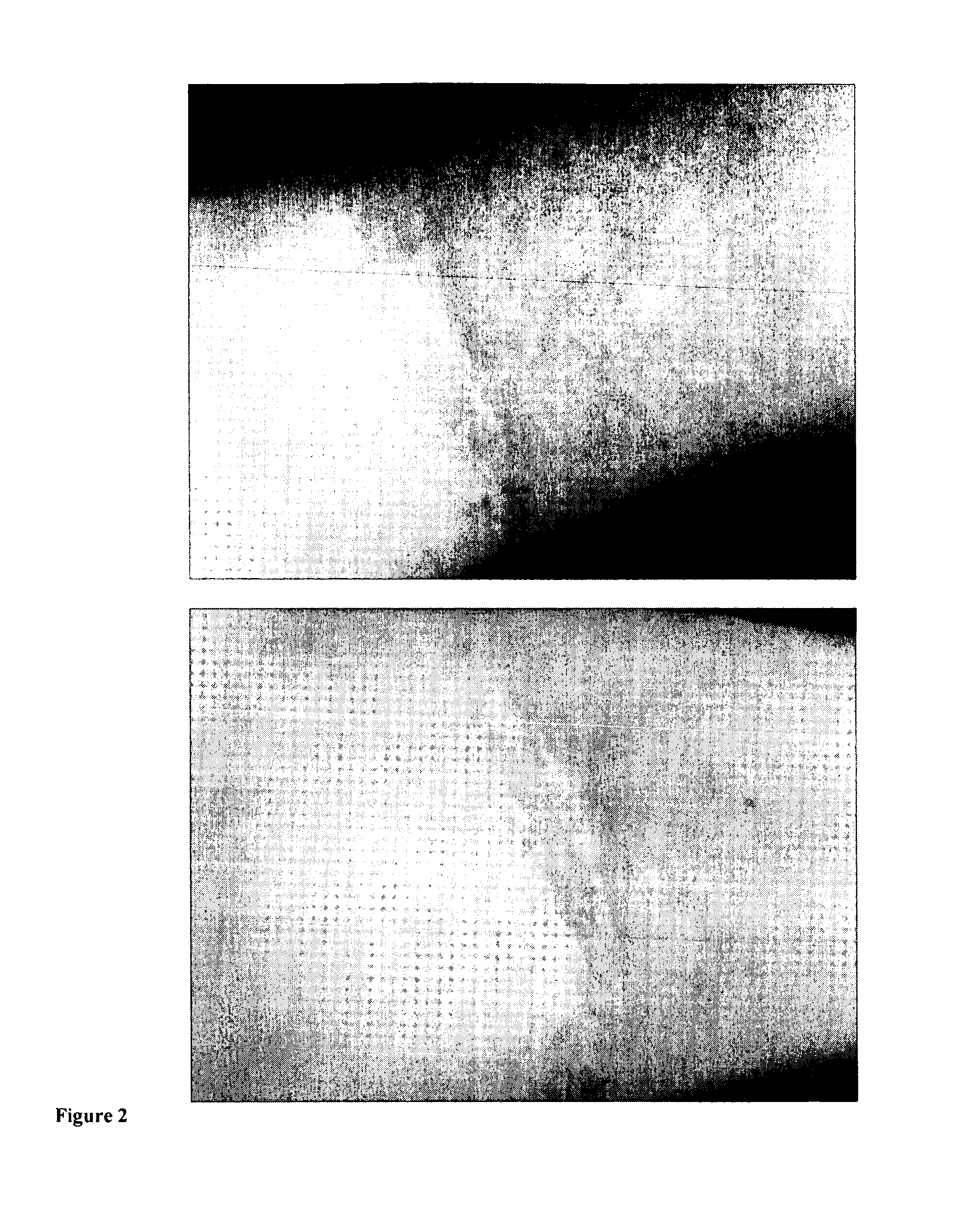 Compositions containing lipid micro- or nanoparticles for the enhancement of the dermal action of solid particles