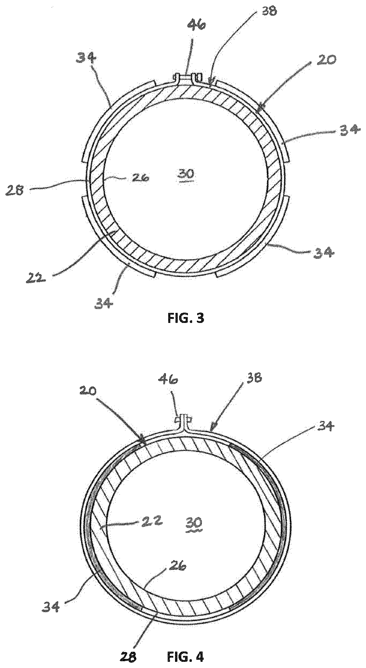 Apparatus and method for decreasing vibrational sensitivity of strain-based measurements of fluid flow parameters for a fluid flow within a conduit