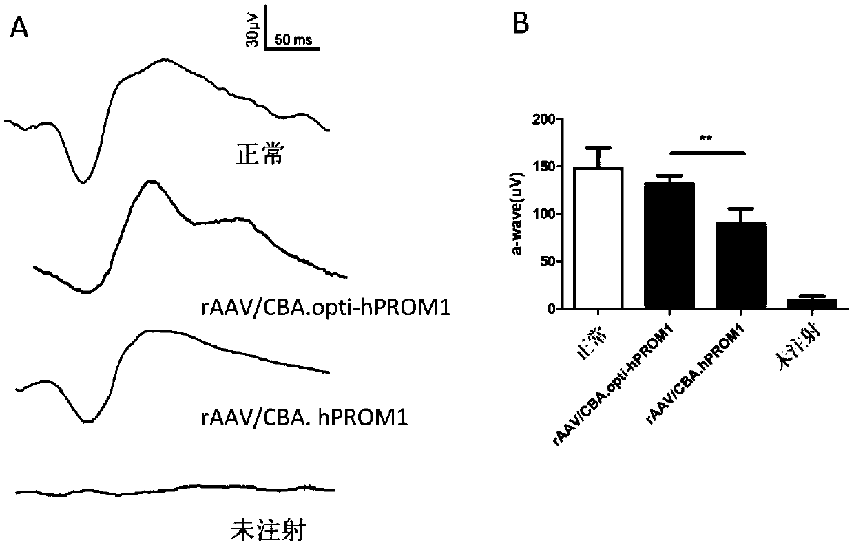 Gene therapy carrier for treating retinitis pigmentosa diseases