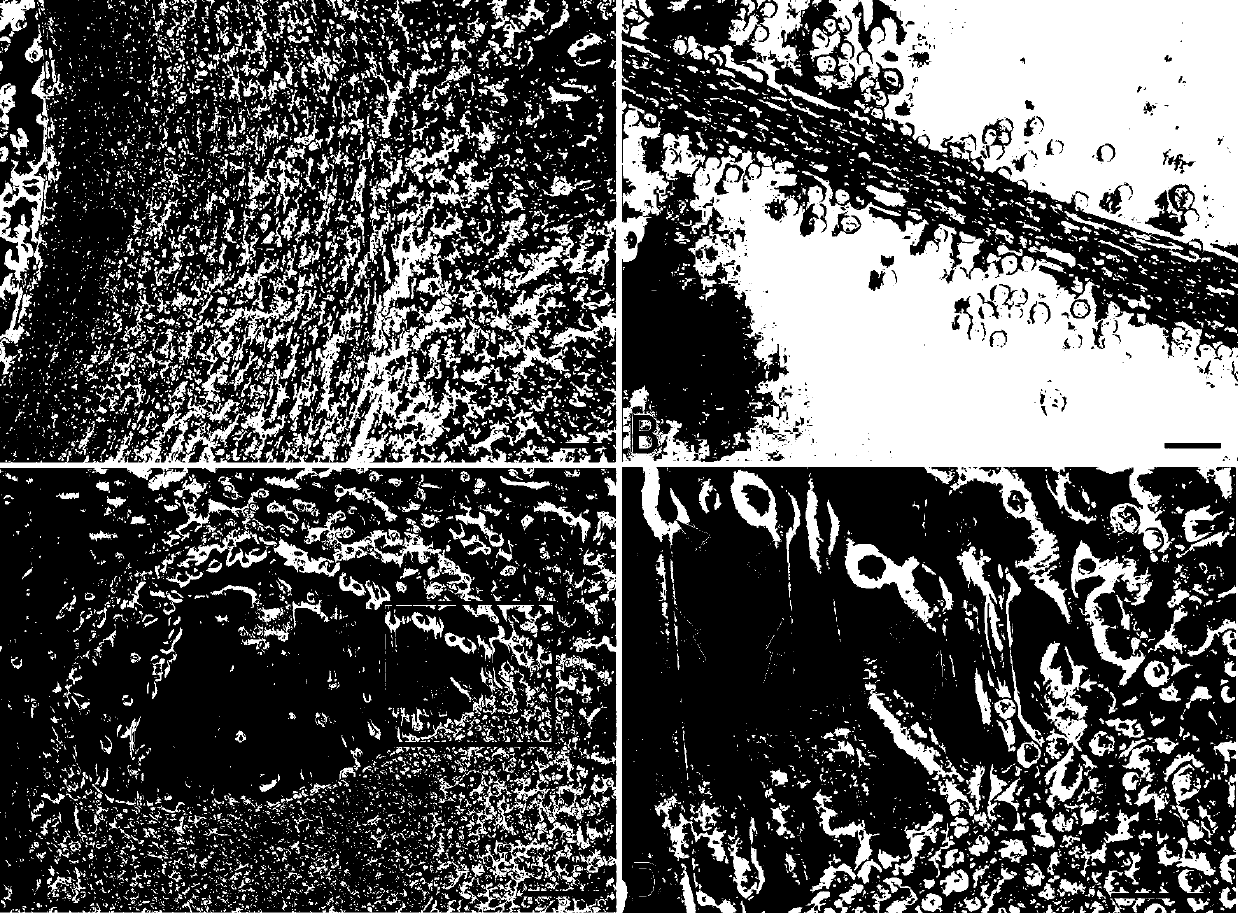 Cardiac muscle ring culture method