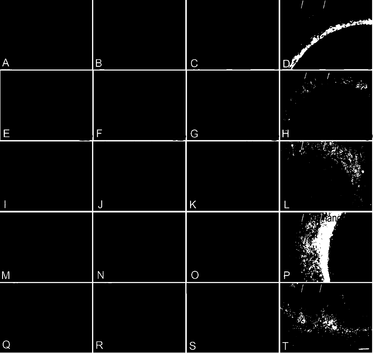 Cardiac muscle ring culture method