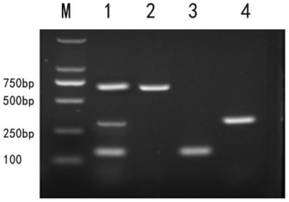 PCR detection method and kit for tularemia and its subspecies