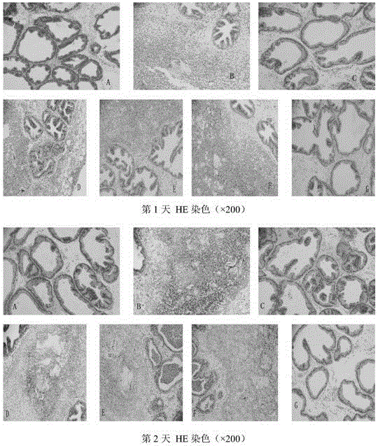 Pharmaceutical composition, herba houttuyniae suppository and preparation method and application