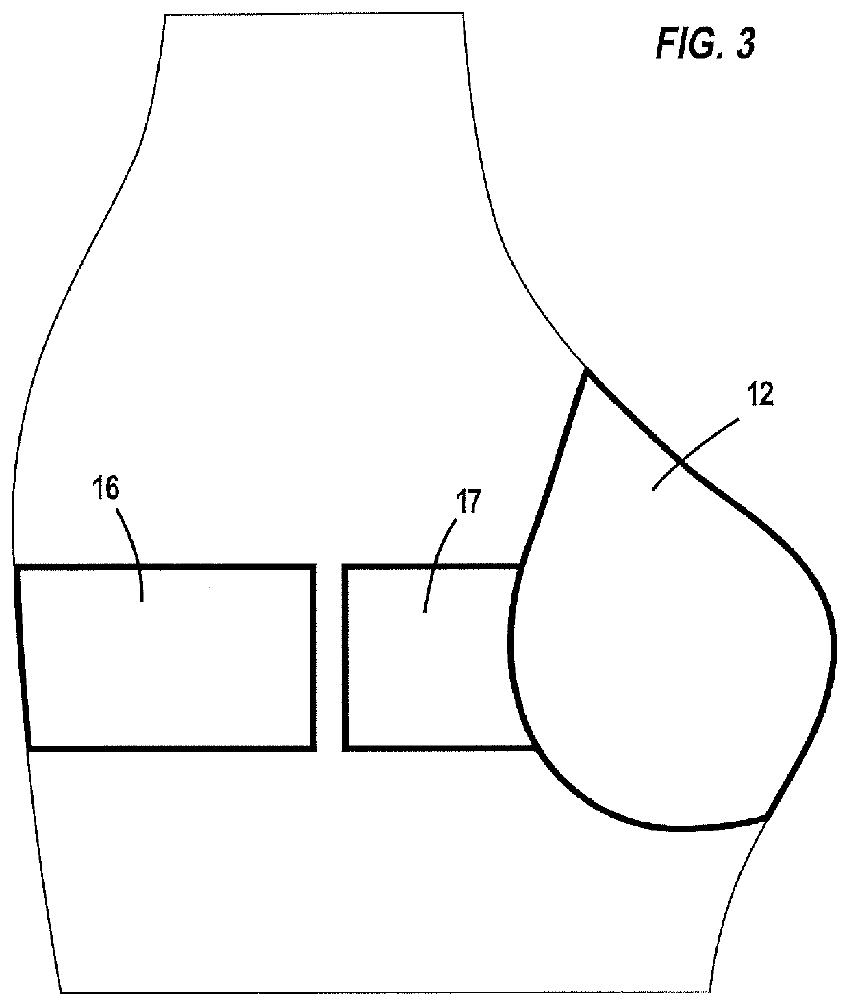 Modular brassiere