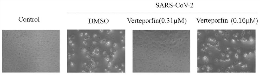 Application of Verteporfin in preparation of medicine for resisting novel coronavirus SARS-CoV-2