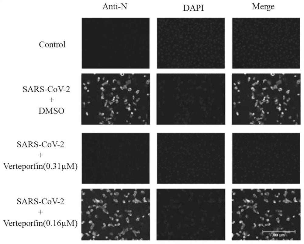 Application of Verteporfin in preparation of medicine for resisting novel coronavirus SARS-CoV-2