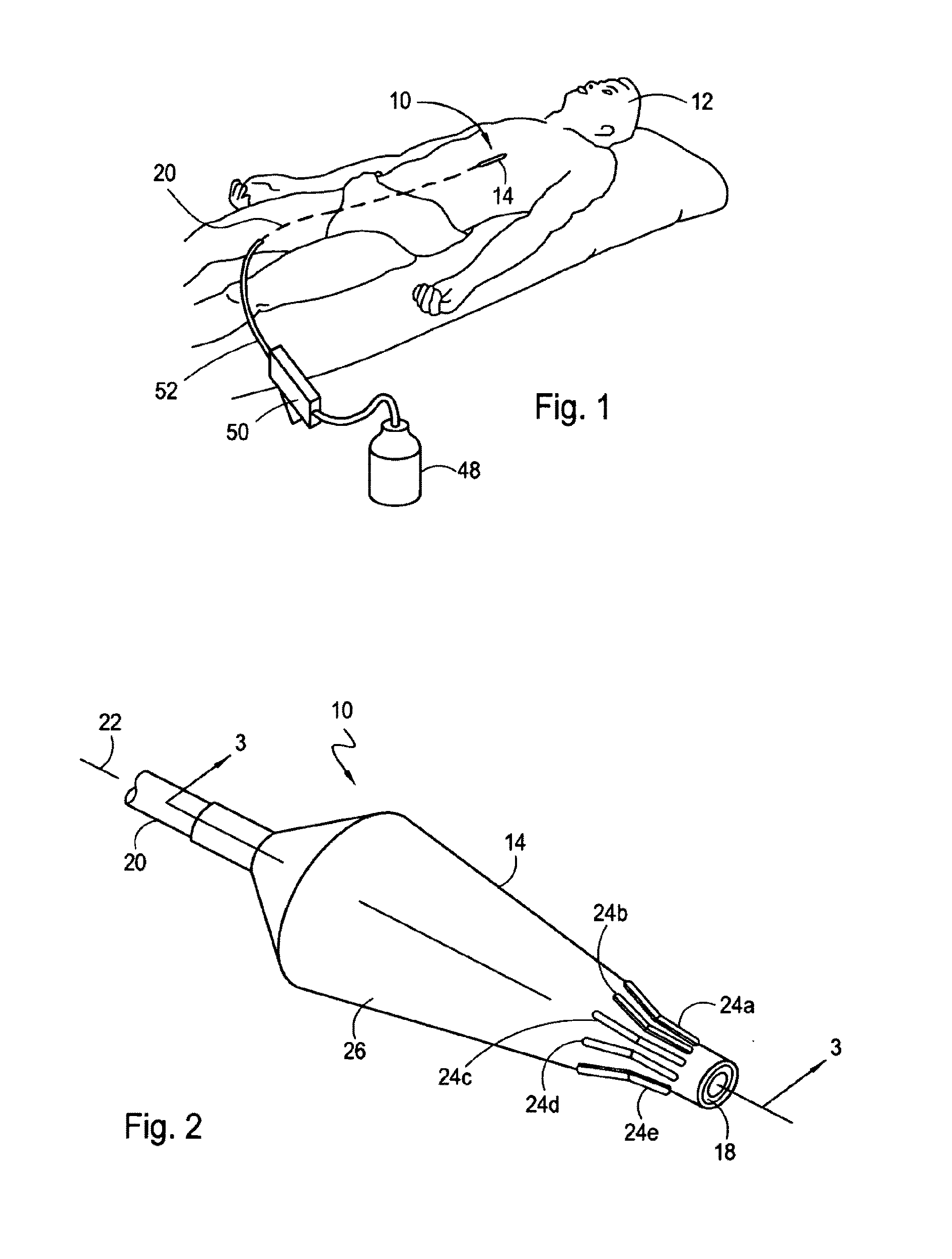 Dilatation Catheter with Enhanced Distal End for Crossing Occluded Lesions