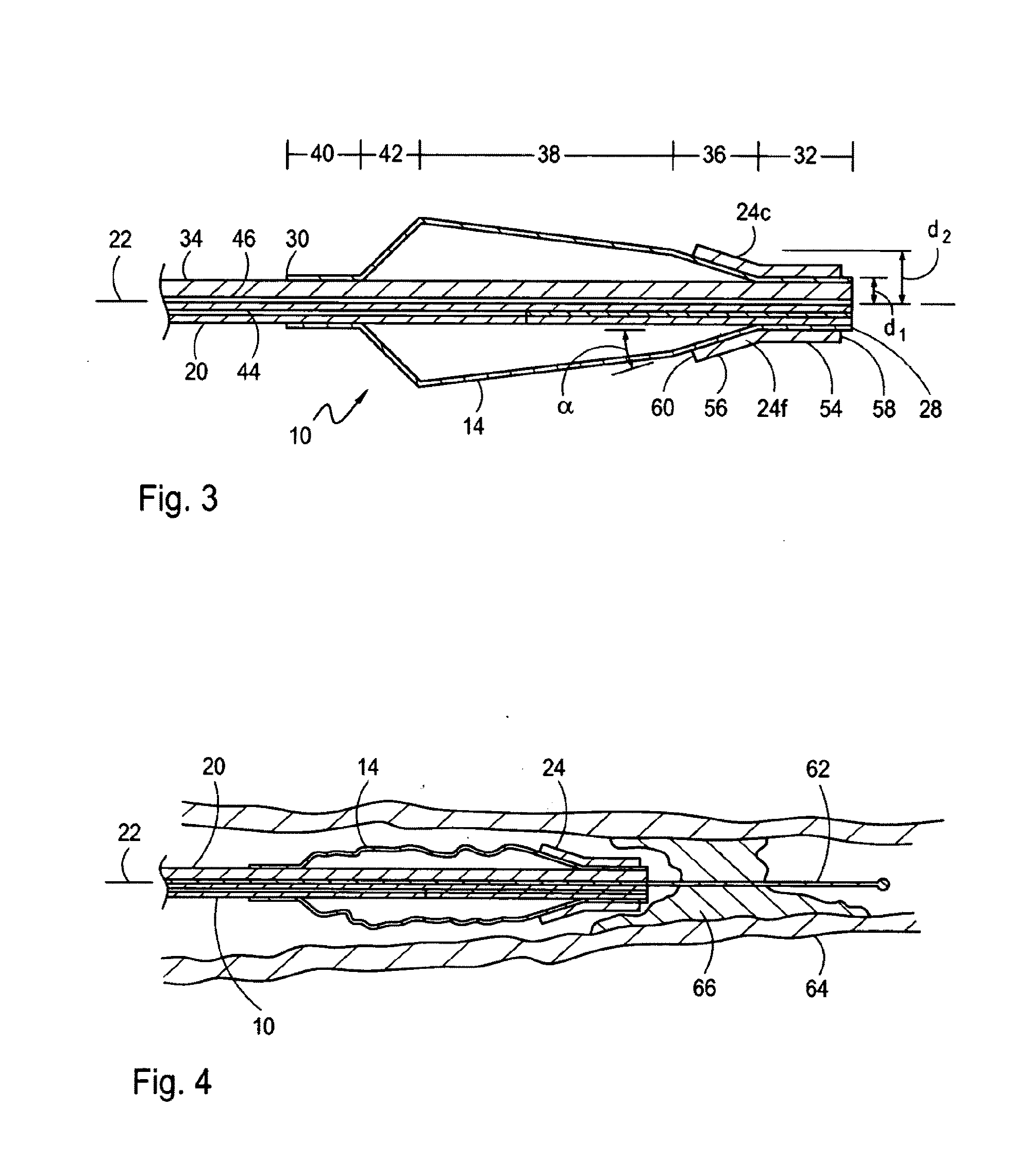 Dilatation Catheter with Enhanced Distal End for Crossing Occluded Lesions