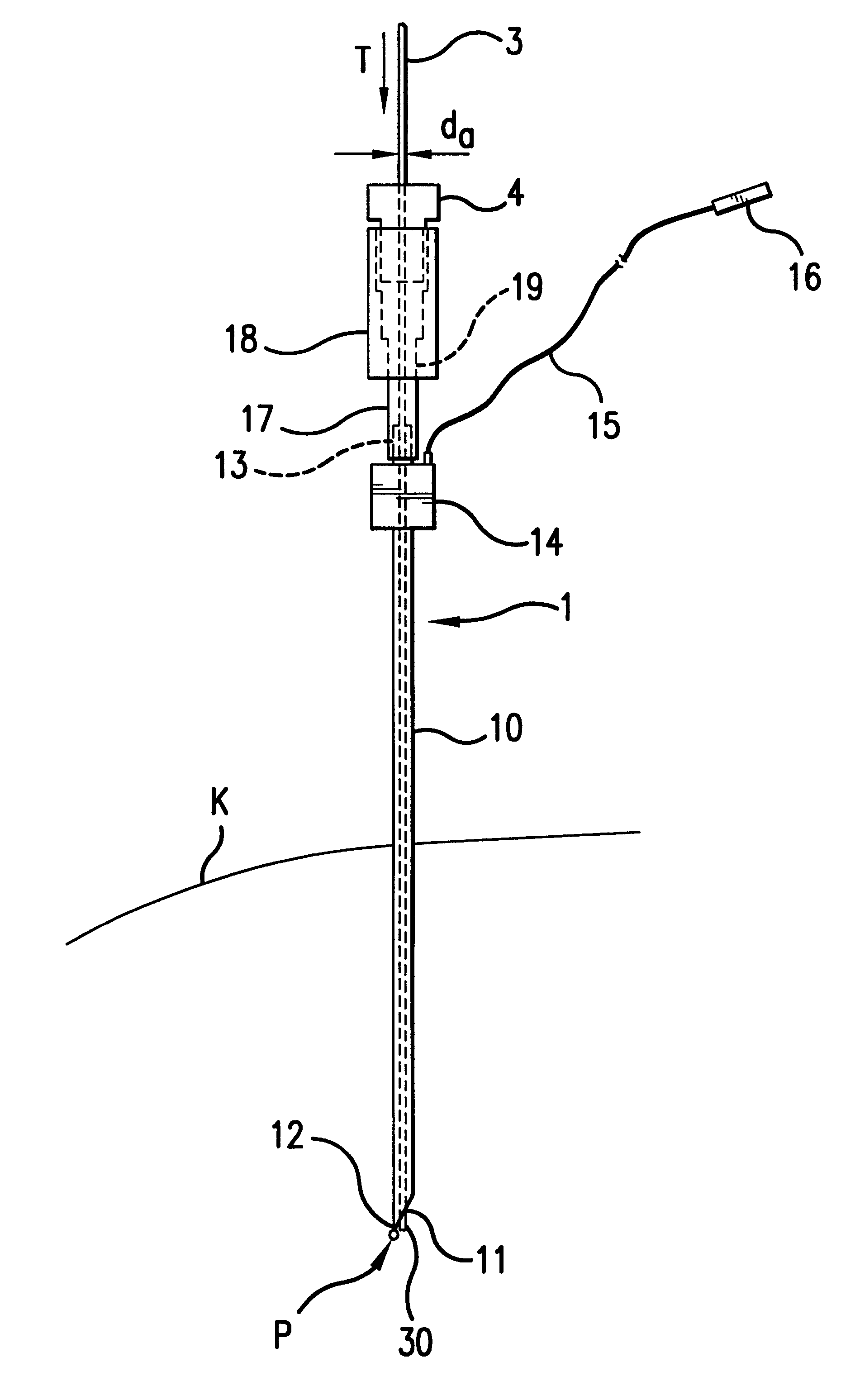Device and method for the location and catheterization of the surroundings of a nerve