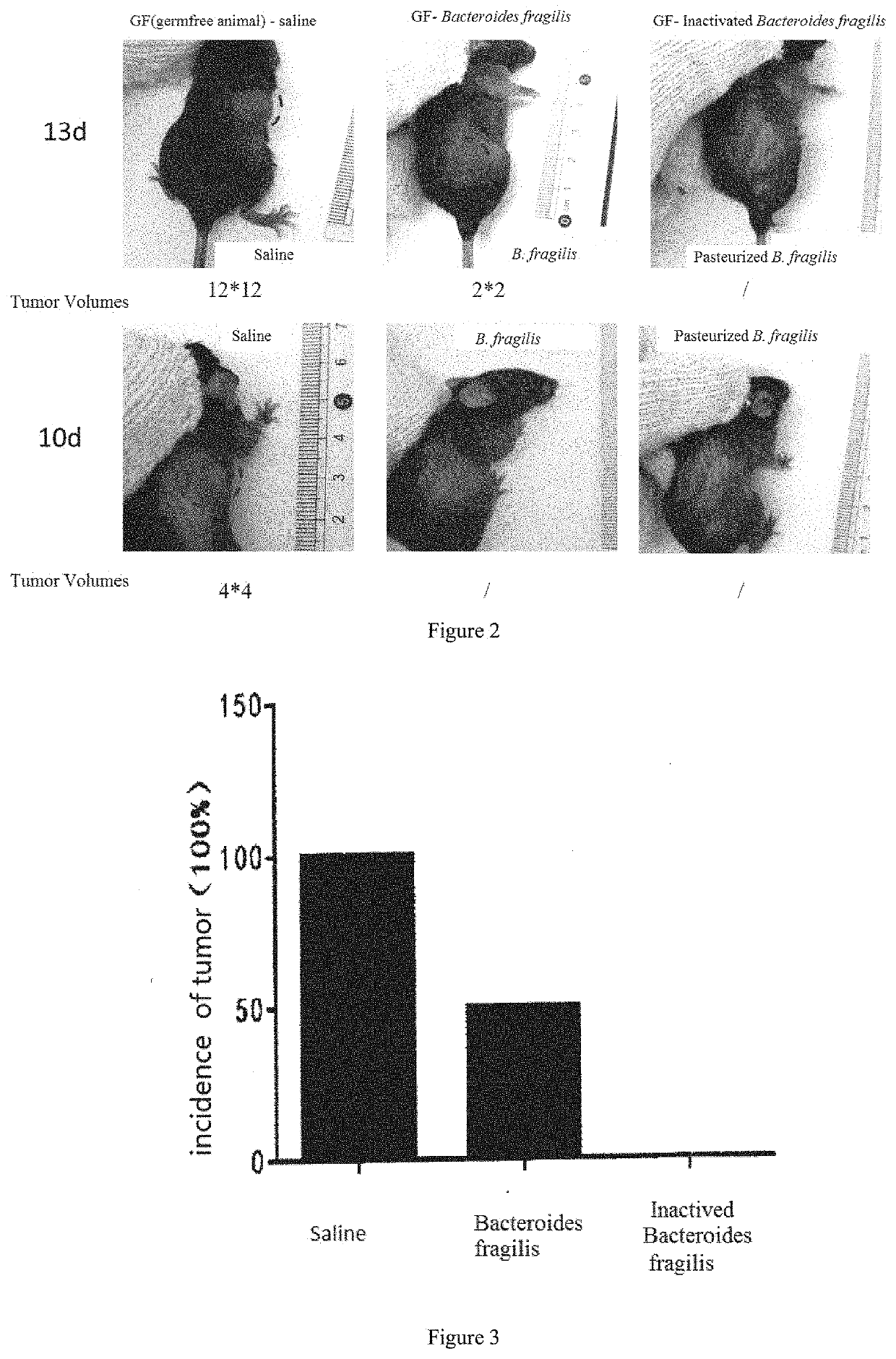 Use of bacteroides fragilis in preparation of medicament for treating and preventing tumor