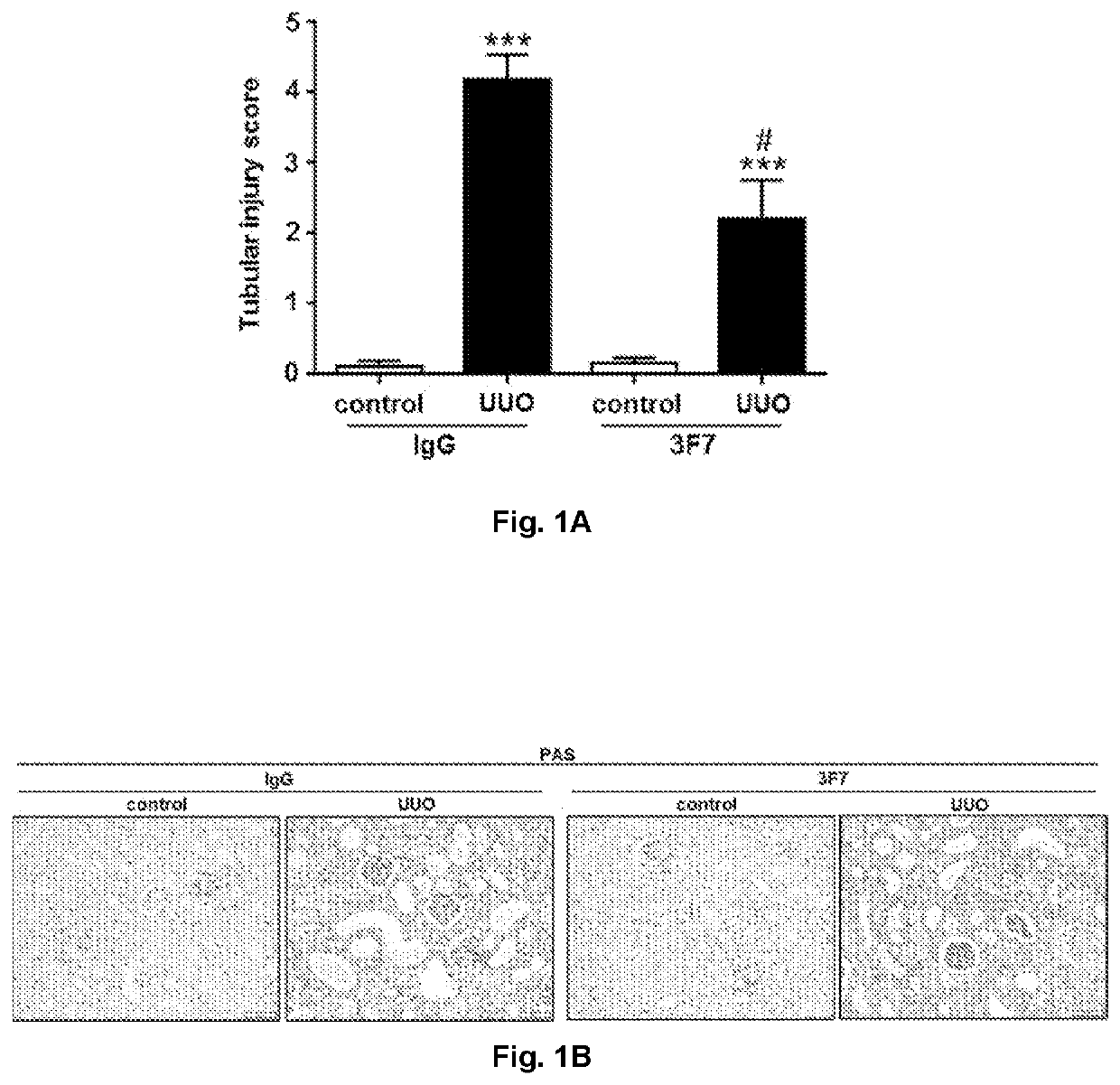 Use of a fxiia-inhibitor in the treatment of renal fibrosis and/or chronic kidney disease