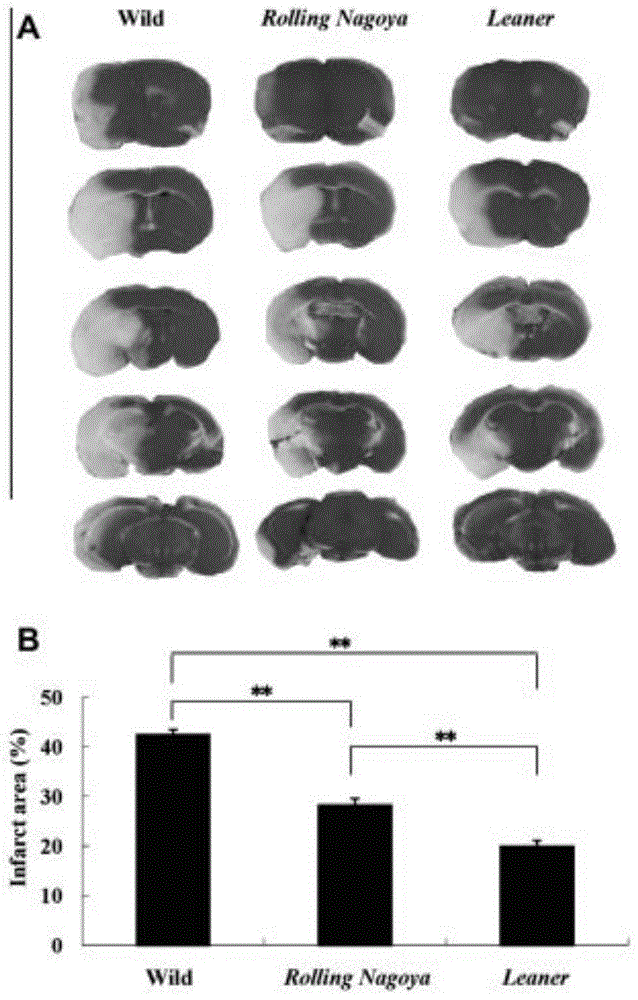 Important effects of CaV2.1 channel in Ca&lt;2+&gt; dependent ischemic models