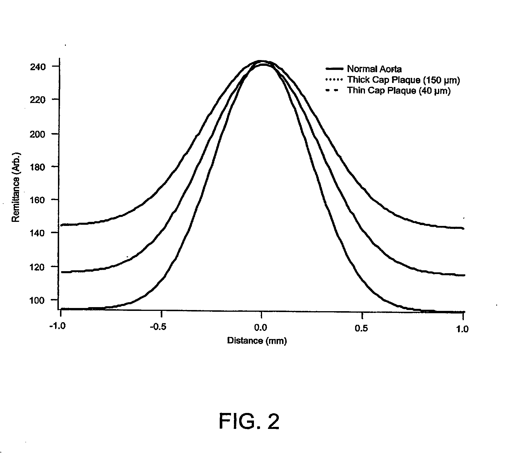 Method and apparatus for determination of atherosclerotic plaque type by measurement of tissue optical properties