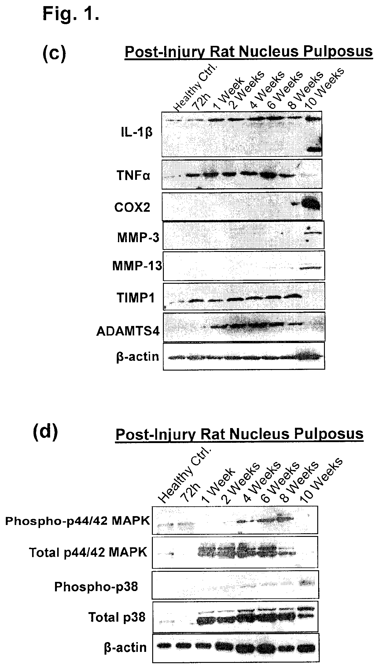 Compositions and methods comprising growth factors, chondroitin and glucosamine for degenerative disc regeneration