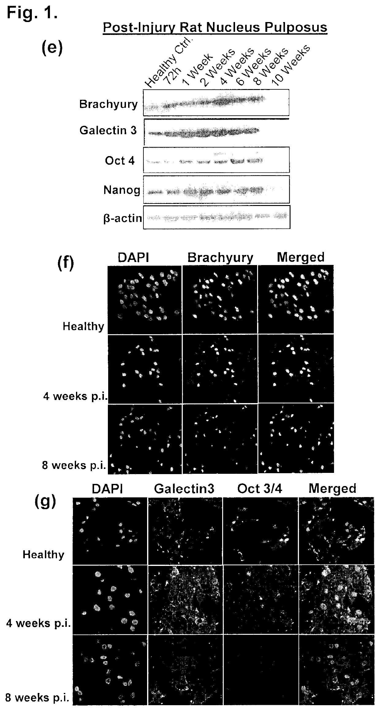 Compositions and methods comprising growth factors, chondroitin and glucosamine for degenerative disc regeneration