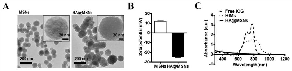An intelligent macrophage tumor targeting therapy system and its preparation method and application