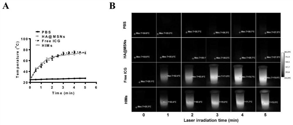 An intelligent macrophage tumor targeting therapy system and its preparation method and application