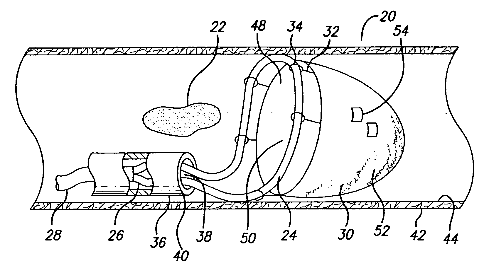 Expandable emboli filter and thrombectomy device