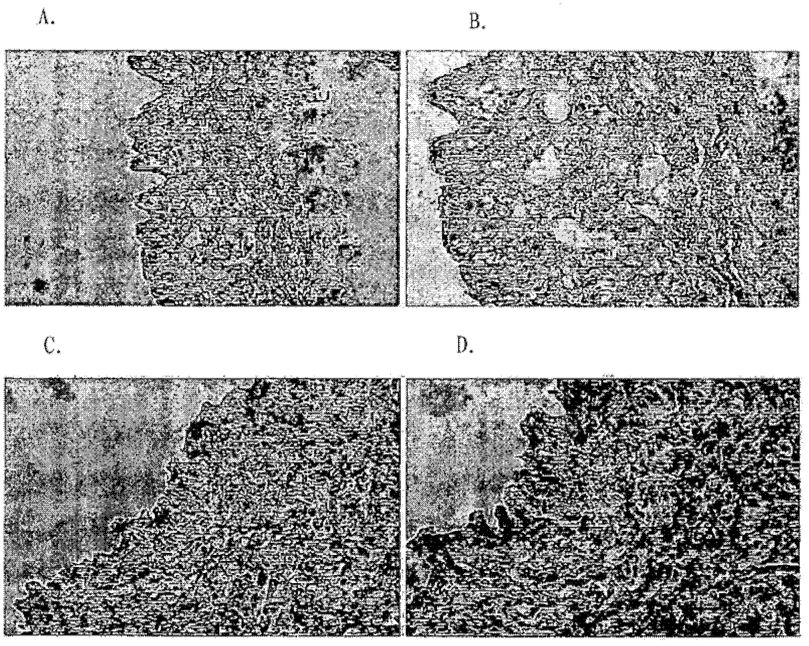 Production method for cryopreserved acellular dermal matrix, and cryopreserved acellular dermal matrix produced thereby
